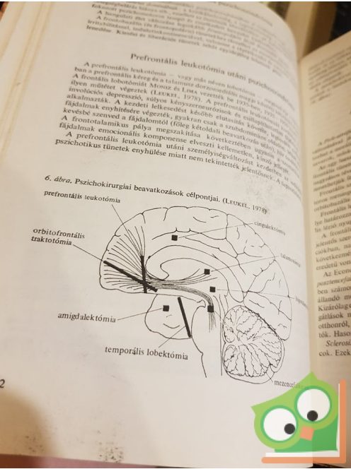 Péter Ágnes: Neurológia, neuropszichológia